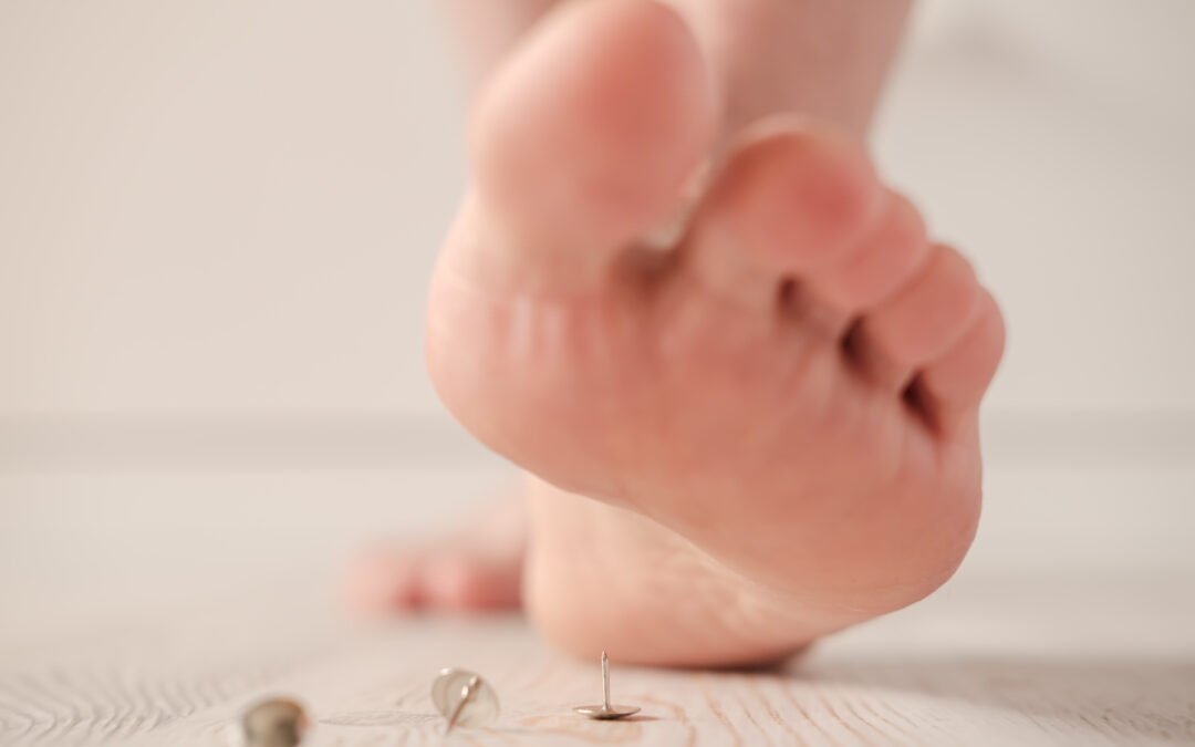 Steep on metal pins, what neuropathy can feel like. West Coast Podiatry Center